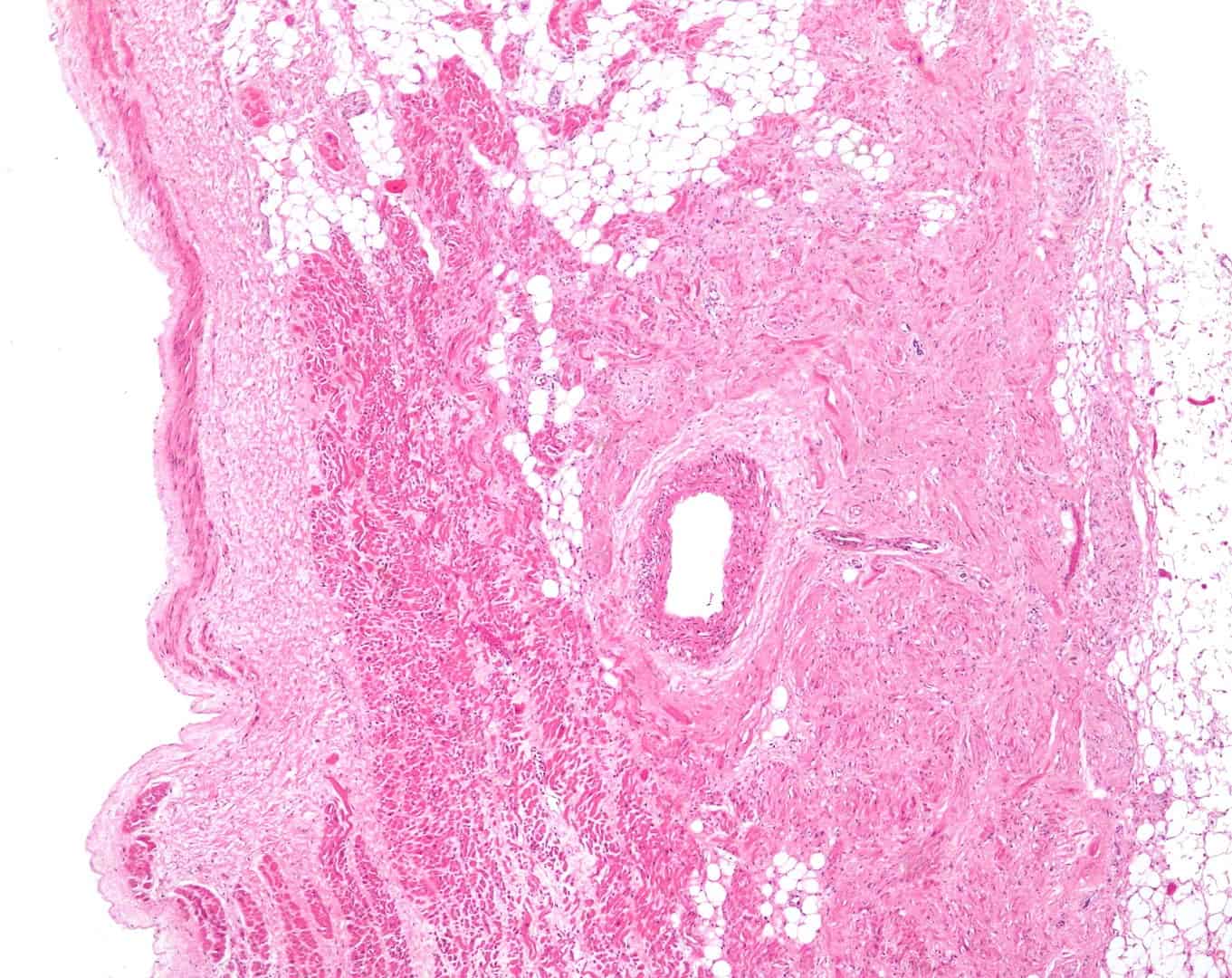 Facts About the Heart, SA Node Under a Microscope