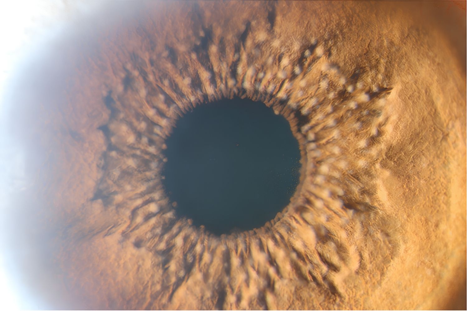 25-facts-about-koeppes-nodules